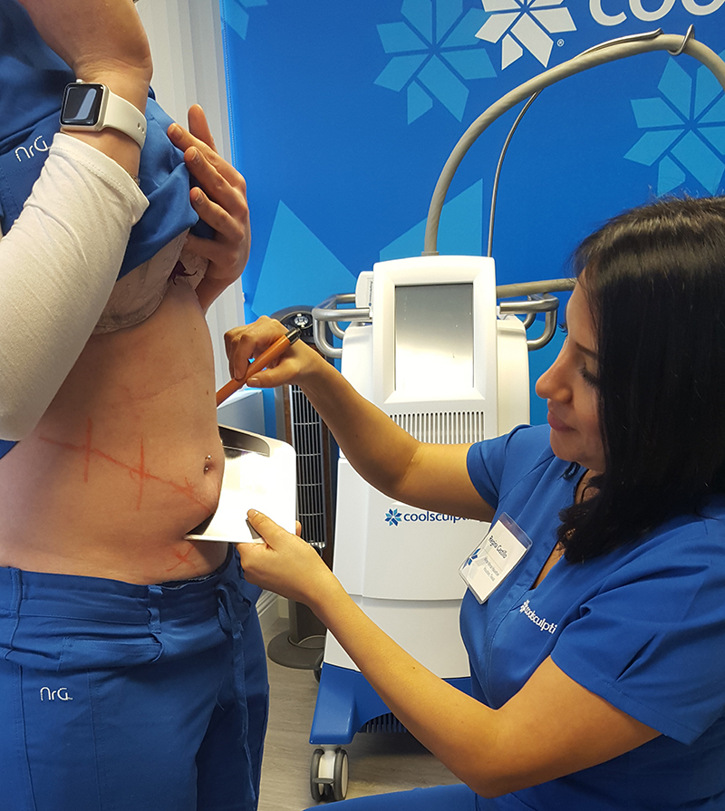 Something Old, Something New | Coolsculpting | Houston, TX