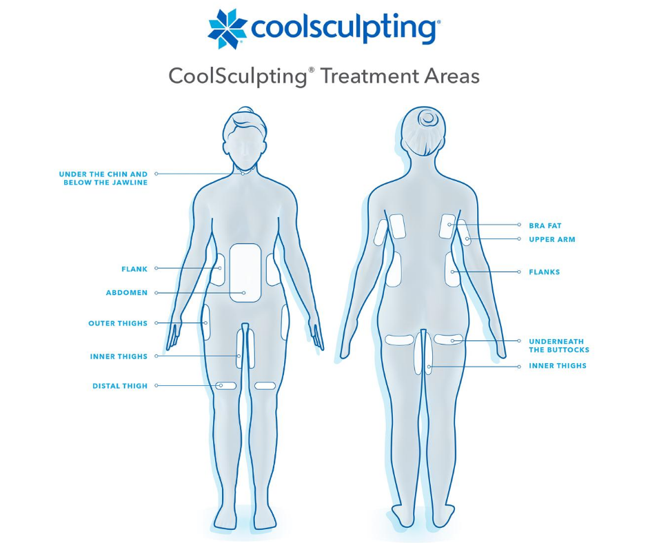 CoolSculpting-Treatment-Areas